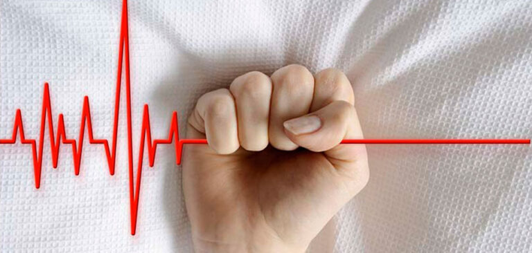 La eutanasia era esto